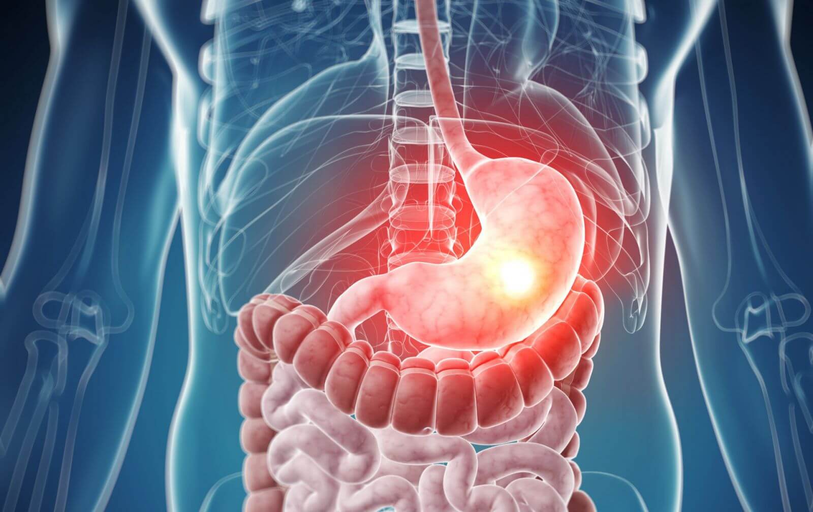 Лечение язвы желудка БАД'ами NSP